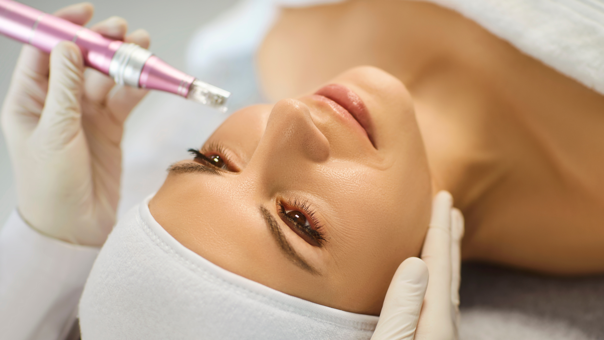 femme qui fait du microneedling