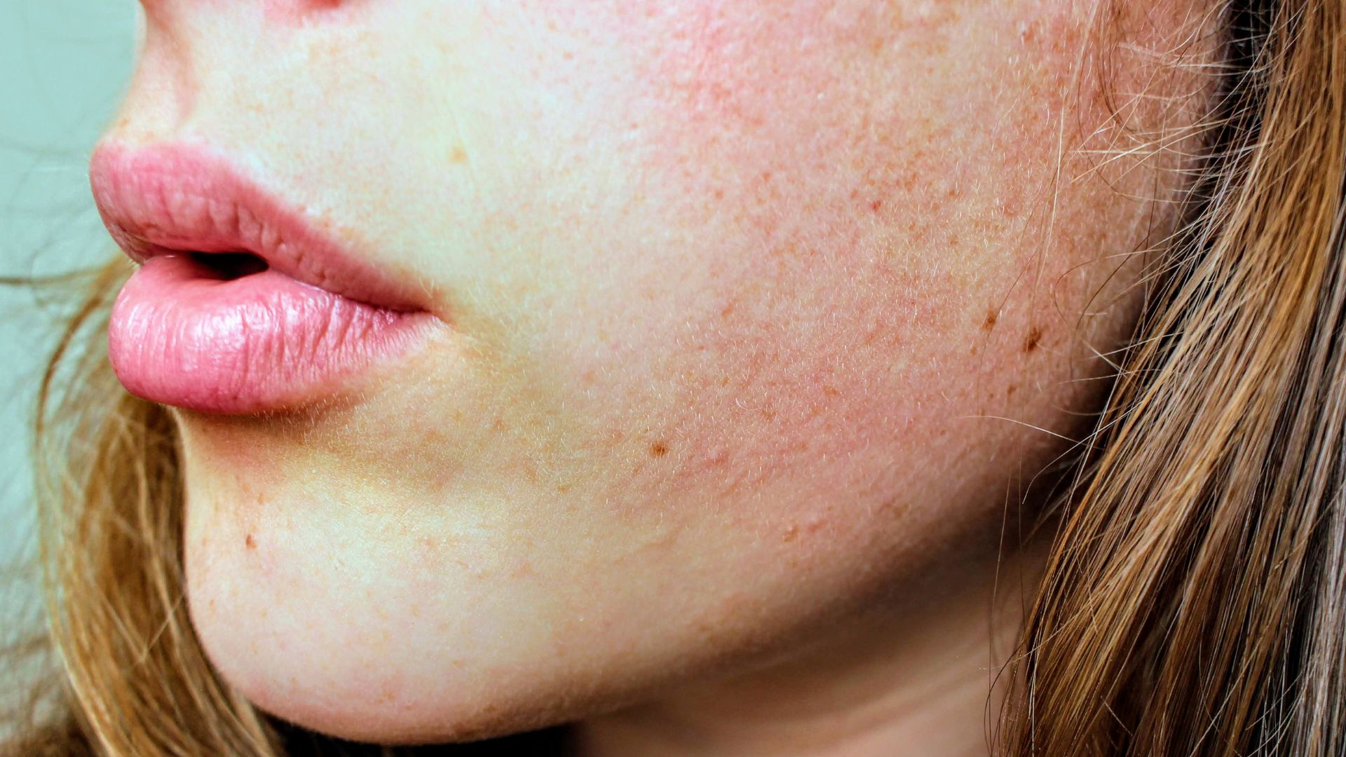 SÉRUM à base de peptides