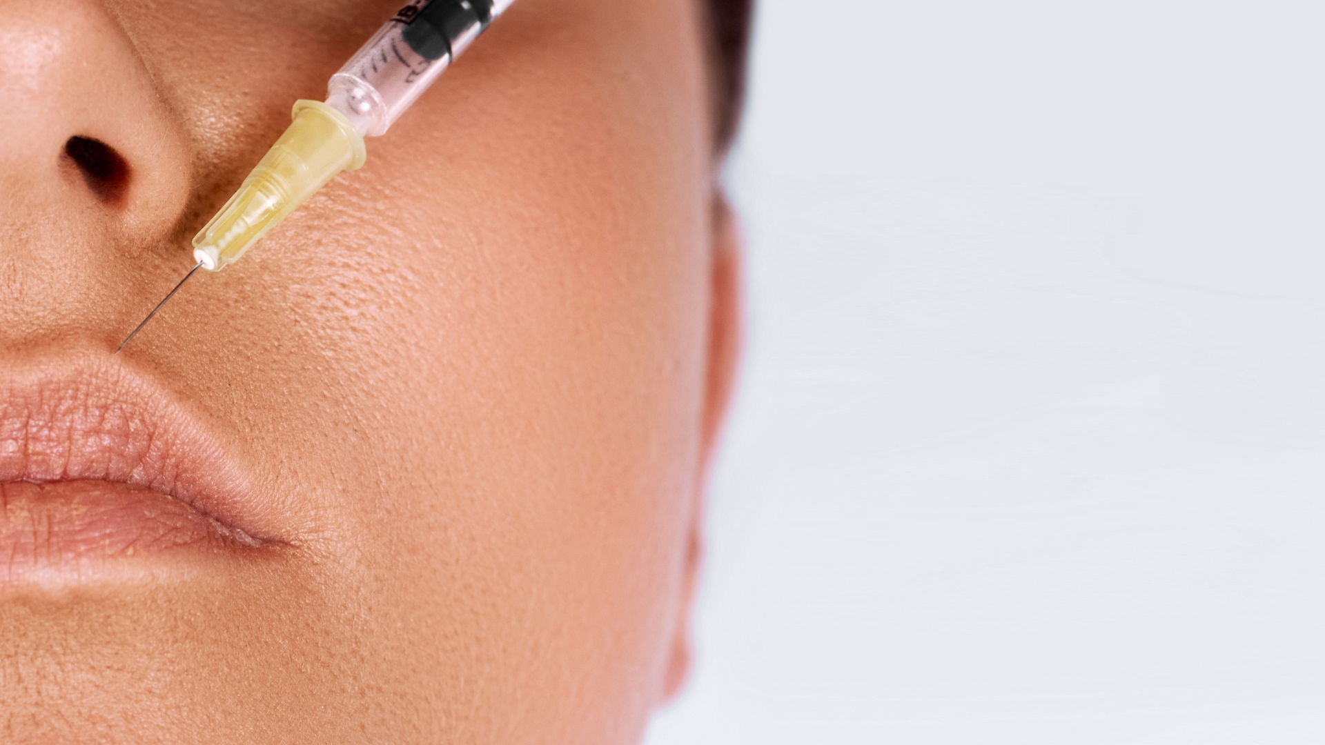 microneedling