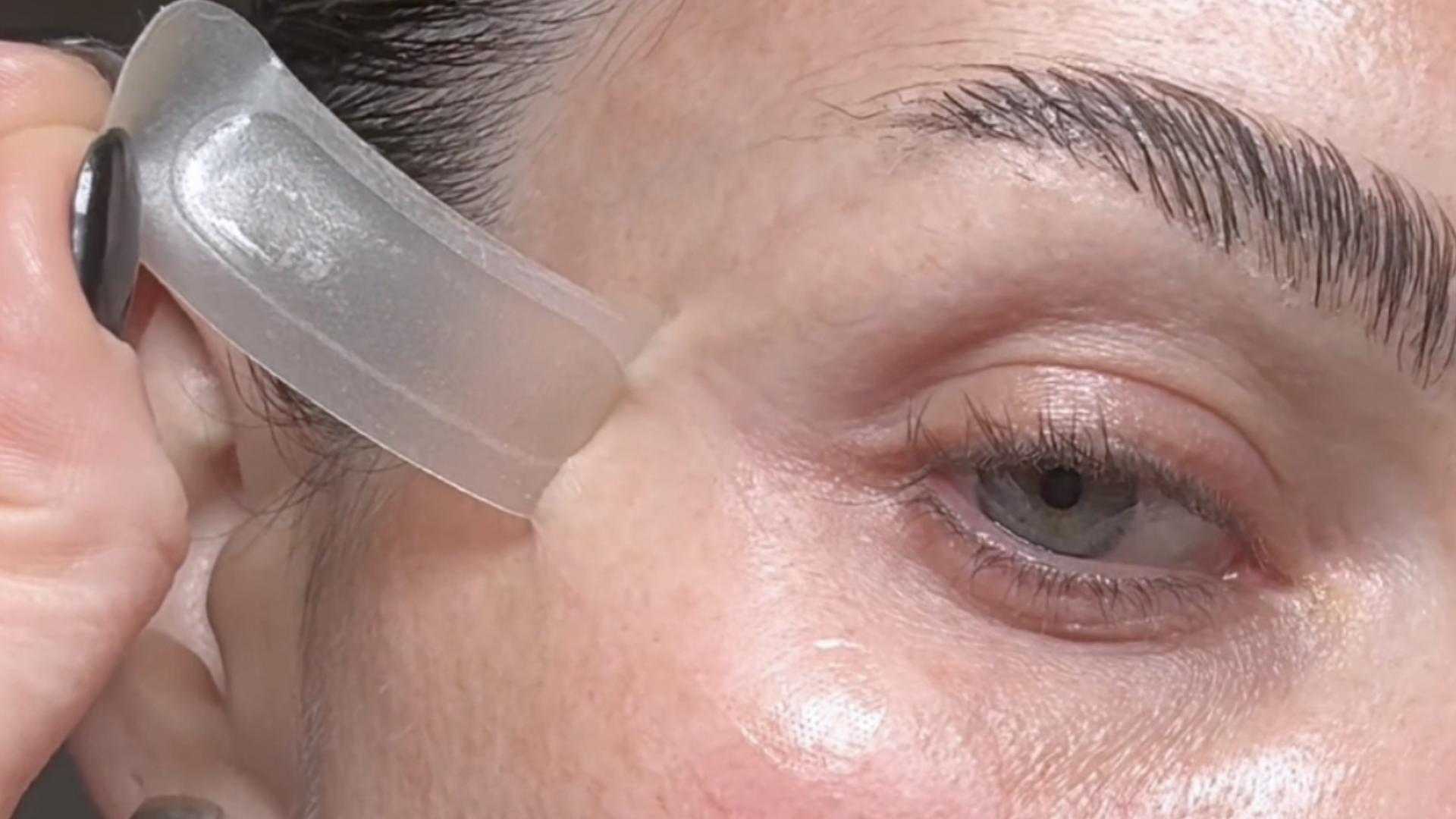 femme qui retire patch microstructure