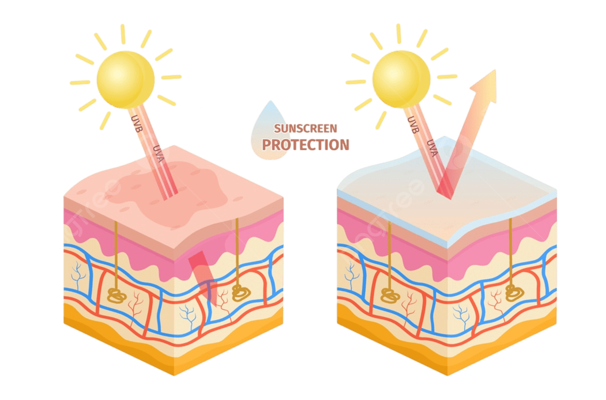 Facteur externe qui abiment la peau et entrainent des rides